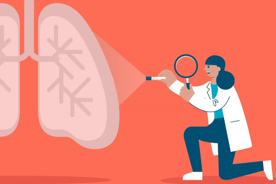 Рак легень - сучасні методі лікування та прогнози виживання