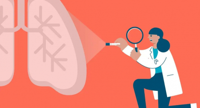 Рак легень - сучасні методі лікування та прогнози виживання