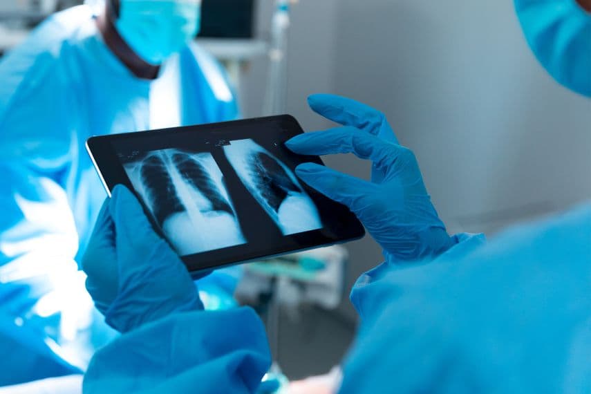 Рак легень - сучасні методі лікування та прогнози виживання